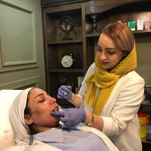 تجارب فيلر الشفايف في ايران مع دكتورة ليلا صالحي