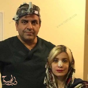 جراحة الانف التجميلية فی ایران مع دکتور احسان خدیوي
