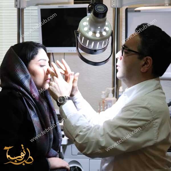 دكتور تجميل الانف في طهران