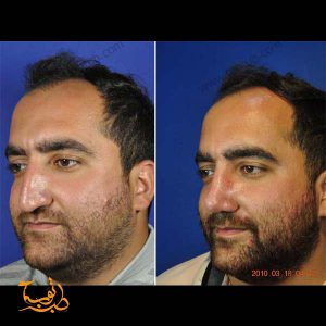 عمليات دكتور مهدي رمضاني ايران مشهد